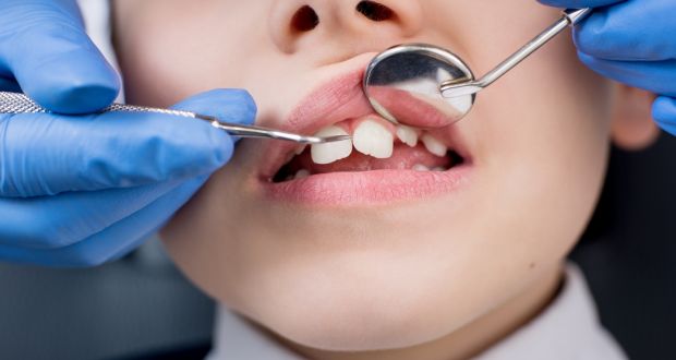 What are the instructions to be followed after the wisdom tooth extraction?